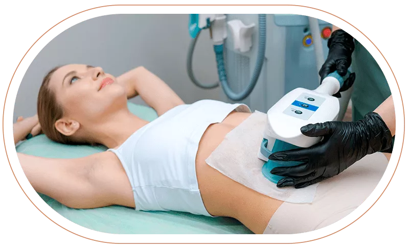 lipo laser